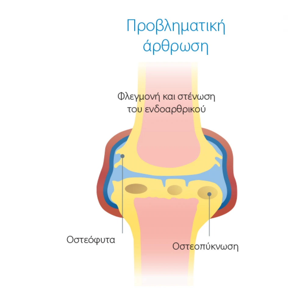 Συμπλήρωμα Διατροφής Χονδροπροστατευτικό για Σκύλους Wejoint Plus Large Breed 30 Δισκία 7 Συμπλήρωμα Διατροφής Χονδροπροστατευτικό για Σκύλους Wejoint Plus Large Breed 30 Δισκία - Image 5